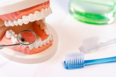 虫歯の治療法と虫歯を防ぐ方法について
