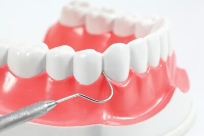歯茎の腫れにはどんな原因がある？腫れてしまったらどうしたらいい？