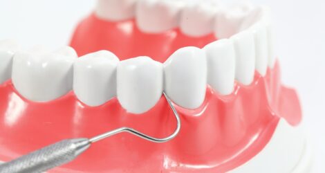 歯茎の腫れにはどんな原因がある？腫れてしまったらどうしたらいい？