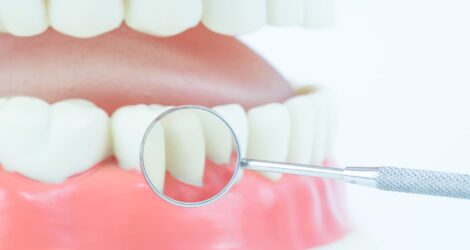 歯茎が痛い原因とは？放置するリスク・痛みを緩和するための対処法も