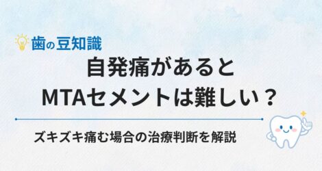 自発痛があるとMTAセメントは難しい？ズキズキ痛む場合の治療判断を解説