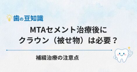 MTAセメント治療後にクラウン（被せ物）は必要？補綴治療の注意点