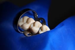 ラバーダム防湿法のイメージ画像