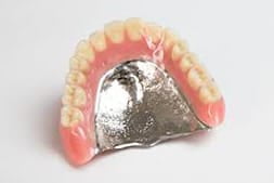 保険適用外の金属床の入れ歯