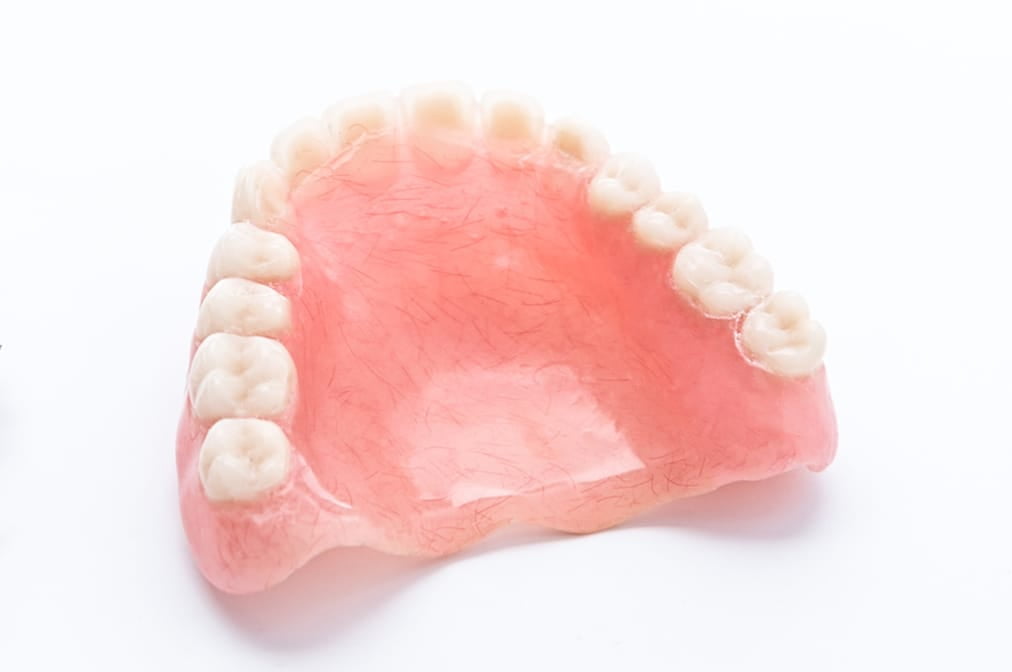 保険適用外のノンクラスプデンチャーの入れ歯