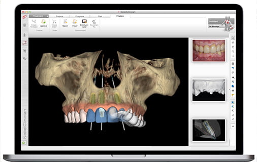 専用ソフトによるシミュレーション説明図