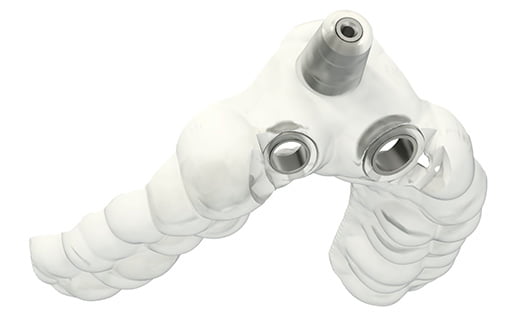 サージカルガイドの説明図