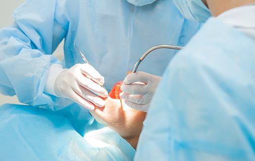 インプラント手術終了の画像