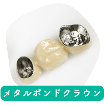 メタルボンドクラウン