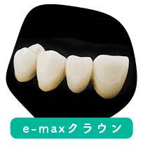 e-maxクラウン