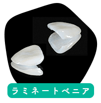 ラミネートべニア