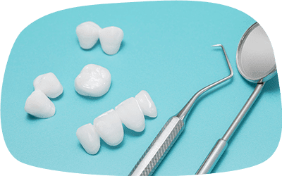 インレーとクラウン