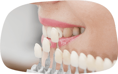 ホワイトニング後の歯のトーンを細かく確認する口元