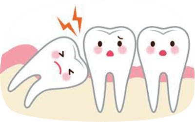 横に生えた親知らずのイメージ画像