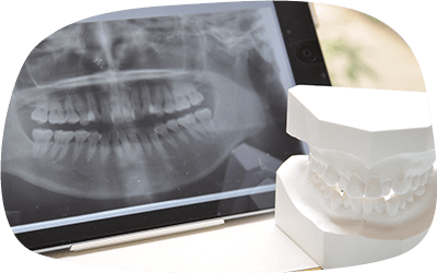 CT撮影のデータと模型