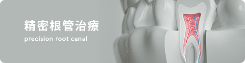精密根管治療